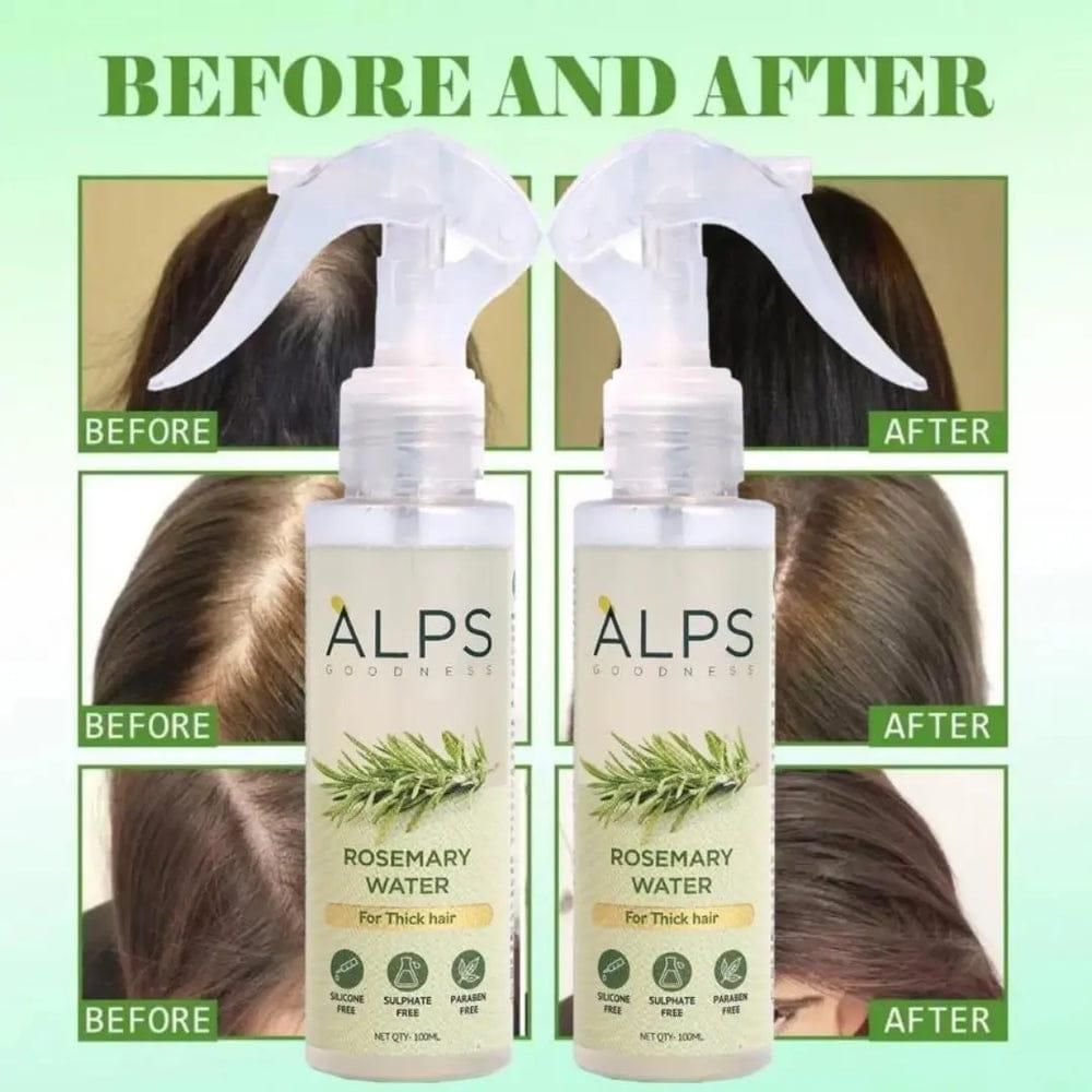 Alps Rosemary Water, Hair Spray For Regrowth Buy 1 Get 2 Free (200 ml)